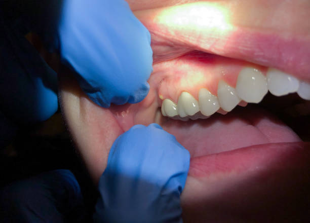 Best Urgent Dental Care for Toothache in Kensett, AR